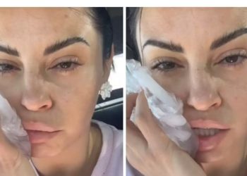 Ατύχημα για την Δήμητρα Αλεξανδράκη: «Προσγειώθηκε η μπάρα στο κεφάλι μου »