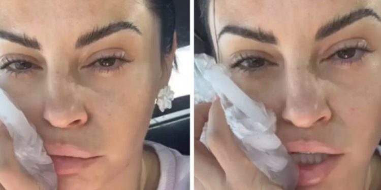 Ατύχημα για την Δήμητρα Αλεξανδράκη: «Προσγειώθηκε η μπάρα στο κεφάλι μου »