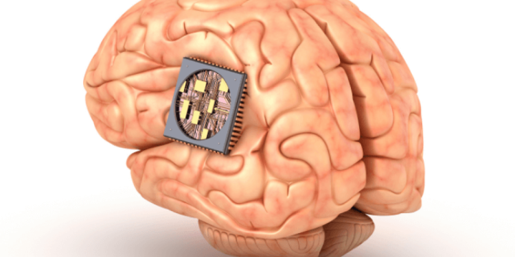 Έλον Μασκ: Τσιπ εγκεφάλου και σε δεύτερο ασθενή εμφύτευσε η Neuralink