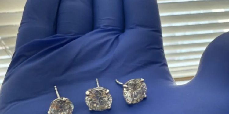 Κλέφτης κατάπιε διαμαντένια σκουλαρίκια αξίας 769.500 δολαρίων