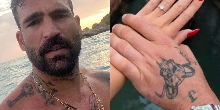 Δημήτρης Αλεξάνδρου: Έσβησε το τατουάζ που είχε κάνει για την Ιωάννα Τούνη στο χέρι του μετά τον χωρισμό τους